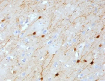 Calbindin 2 Antibody / CALB2 / Calretinin - image 1