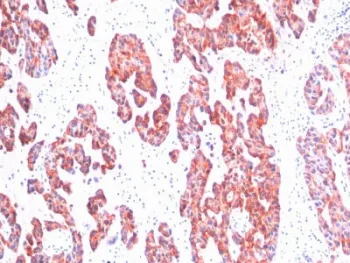 Basic Cytokeratin Antibody (HMW / Type II) - image 1