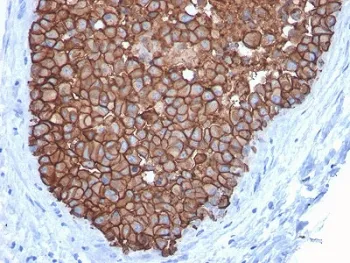 HER2 Antibody / ErbB2 - image 1