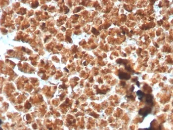 Glycoprotein 2 Recombinant Antibody / GP2 / ZAP75 - image 1