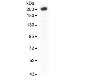 SPTA1 Recombinant Antibody / Spectrin alpha 1 - image 1
