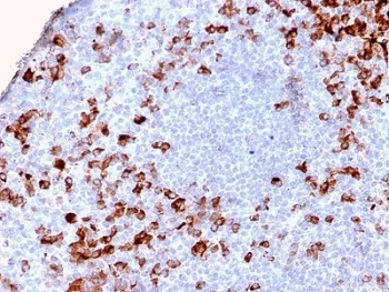 Kappa Light Chain Recombinant Antibody - image 1