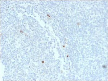 IgM Heavy Chain Recombinant Antibody - image 1