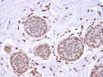 Mammaglobin A Recombinant Antibody / SCGB2A2 - image 1