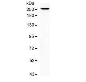 SPTBN2 Recombinant Antibody / Spectrin beta III - image 1