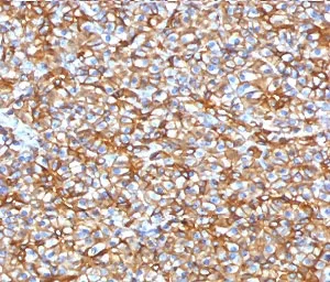 SPTBN2 Recombinant Antibody / Spectrin beta III - image 1