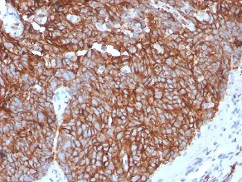 GLUT1 Recombinant Antibody / SLC2A1 - image 1