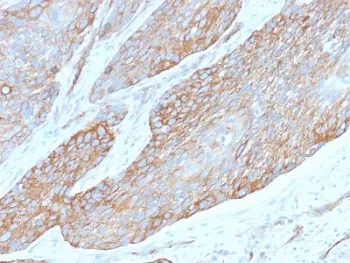 SPTBN2 Recombinant Antibody / Spectrin beta III - image 1