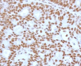 TLE1 Recombinant Antibody - image 1