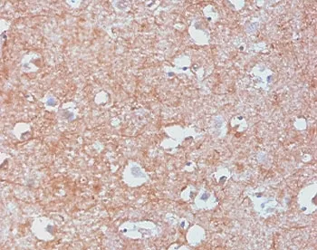 Neurofilament Recombinant Antibody (-Light) / NF-L / NEFL - image 1