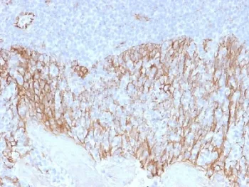 Beta Catenin Antibody - image 1