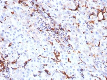 Cathepsin K Antibody / CTSK - image 1