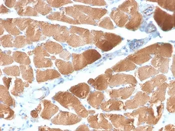 Desmin Recombinant Antibody (Muscle cell marker) - image 1