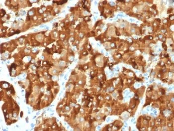 AMACR / p504S Antibody (Prostate Cancer Marker) - image 1