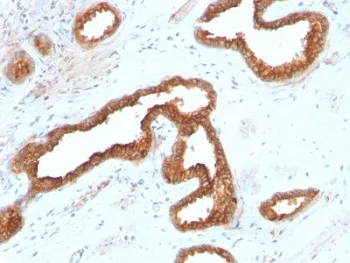 AMACR / p504S Recombinant Antibody (Prostate Cancer Marker) - image 1