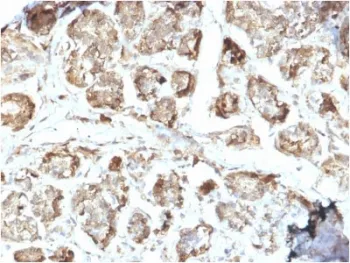 NME2 Antibody / NM23-H2 - image 1