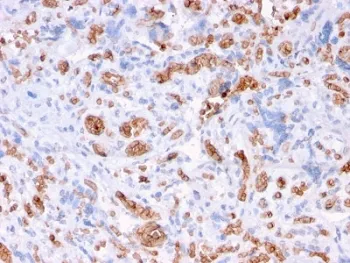 SPTA1 Recombinant Antibody / Spectrin alpha 1 - image 1