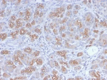 Golgi Recombinant Antibody - image 1