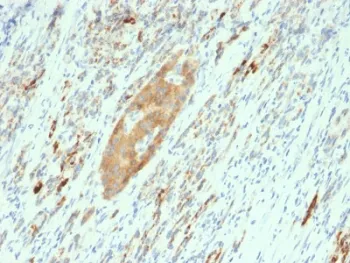 GAD65 Antibody - image 1