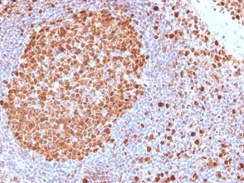 MCM7 Recombinant Antibody - image 1