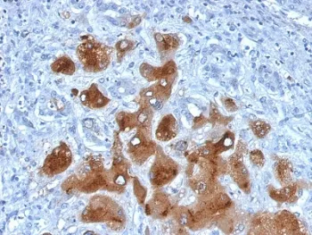 Serum Amyloid A Antibody / SAA1 + SAA2 - image 1
