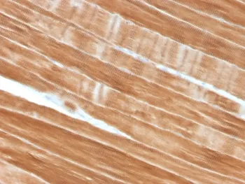 ACTN2 Antibody / Alpha Actinin 2 / Sarcomeric Alpha Actinin - image 1