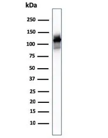 ACTN2 Antibody / Alpha Actinin 2 / Sarcomeric Alpha Actinin - image 1