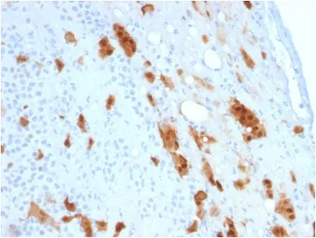 Calbindin 2 Antibody / CALB2 / Calretinin - image 1