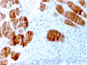 ACTN2 Antibody / Alpha Actinin 2 / Sarcomeric Alpha Actinin - image 1