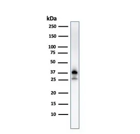 Nucleophosmin Antibody / NPM1 - image 1