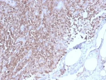 CD3 epsilon Recombinant Antibody - image 1