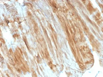 Dystrophin Antibody / DMD - image 1