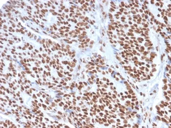 Estrogen Receptor alpha Antibody - image 1