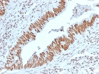 Nucleophosmin Antibody / NPM1 - image 1