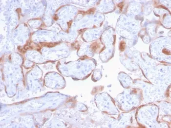 PAPP-A Antibody / Pappalysin-1 - image 1