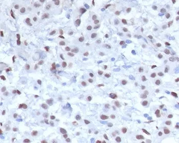 WT1 Recombinant Antibody / Wilms Tumor 1 - image 1