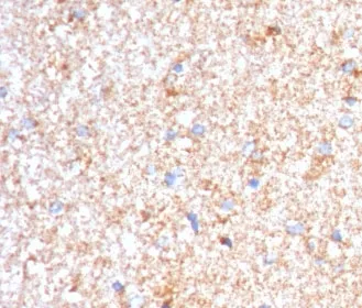 Serum Amyloid P Antibody - image 1