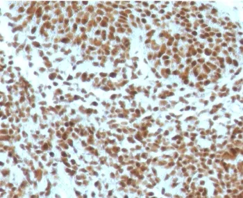 Nucleophosmin Antibody / NPM1 - image 1