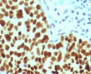 SOX2 Recombinant Antibody - image 1