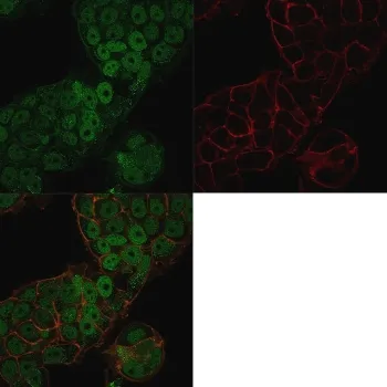 CHD4 Antibody / Chromodomain helicase DNA binding protein 4 - image 1