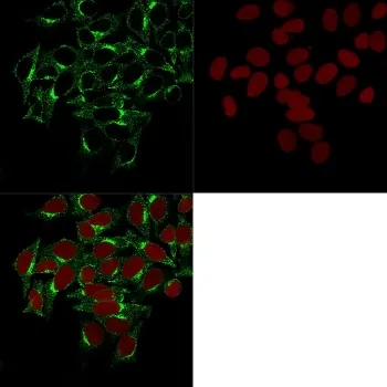 Clathrin Heavy Chain Antibody - image 1