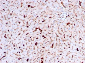 Cathepsin K Antibody / CTSK - image 1