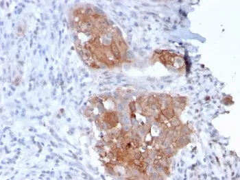 Desmoglein 1 Antibody / DSG1 - image 1