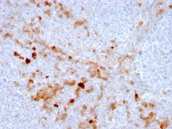 CD105 Antibody / Endoglin - image 1