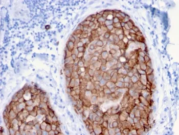 HER2 Antibody / ErbB2 - image 1