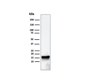 FABP5 Antibody (epidermal) - image 1