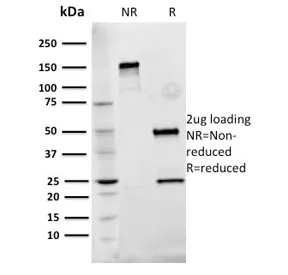 FN1 Antibody / Fibronectin - image 1