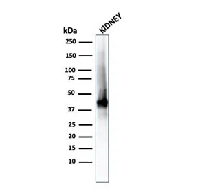 AMACR / p504S Recombinant Antibody (Prostate Cancer Marker) - image 1