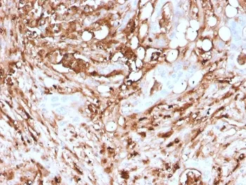 FTL Recombinant Antibody / Ferritin light chain - image 1