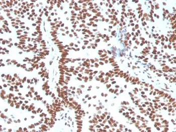 Estrogen Receptor alpha Antibody - image 1